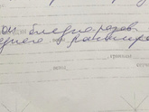 Глазное дно.