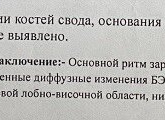 Эхоэнцефалограмма