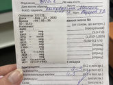 Анализ мочи
