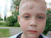 Ребенок ударился на площадке.