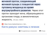 Киста Урахуса