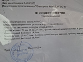Узи