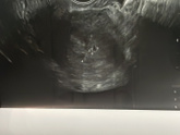 Беременность 🤰