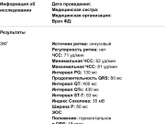 Заключение экг