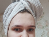 Прыщи