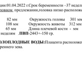 Узи.