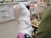 Сломала 5ю кость на