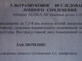 Сходила на УЗИ лонного
