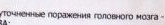 Может ли психиатр в 2 года поставить ЗПР?