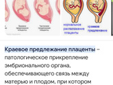 Экватор и 2скрининг !Как быстро летит время!
