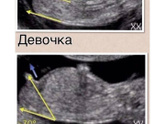 Мальчик или девочка ????