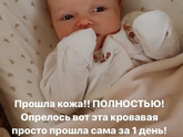 Девочки, чем ещё можно