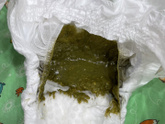 Могут быть зелёные какашки