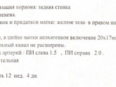 У кого была киста