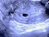 Первое УЗИ 🐣🤰🥰 5 нед 2 дня ( 23 ДПО)