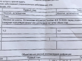 Близорукость