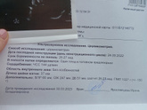 26-27 недель)
