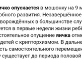 Крипторхизм