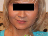 Хочу брекеты очень ,