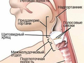 Увеличился надгортанник у ребёнка 😖у кого было такое?