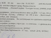 Результаты моего первого УЗИ..
