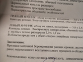 Девочки, ну подскажите кто