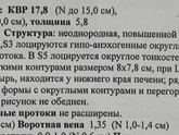 Результаты моей МСКТ...