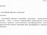 Биопсия