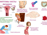 Как болит киста яичника?