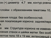 Не верю не верю....