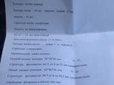 Стимуляция овуляции эндометрий