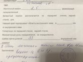 Девочки,Была на узи на