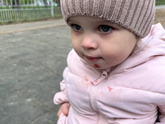 Мокнущая рана на подбородке