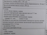 Кисты сосудистых сплетений