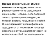 Розеола или на нурофен сыпануло?