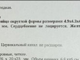 Сходила на УЗИ.
