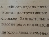 Невролгия.