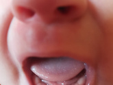 Зубы