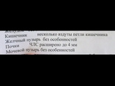 Девочки срок 33 недели