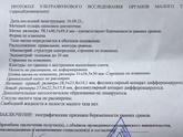 Нарус Узи