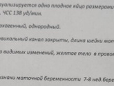 Ну, привет, человек, которого
