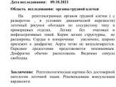 Рентген что это значит