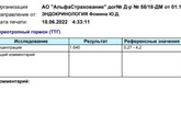 Узлы на щитовидке.