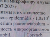 Посев из носа