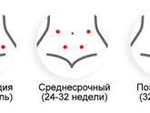 Доплер