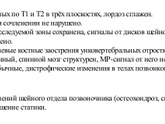 Мрт головы, шеи