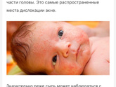 Может кто сталкивался АЛЛЕРГИЯ ПРИ ИВ СЫПЬ