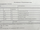 Сегодня была на УЗИ
