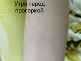 Итоги по диаскину .