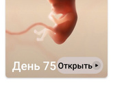 Аневризма
